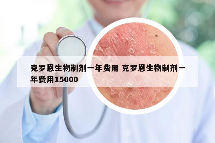 克罗恩生物制剂一年费用 克罗恩生物制剂一年费用15000