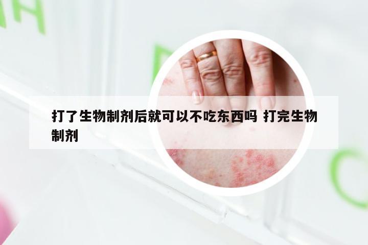 打了生物制剂后就可以不吃东西吗 打完生物制剂