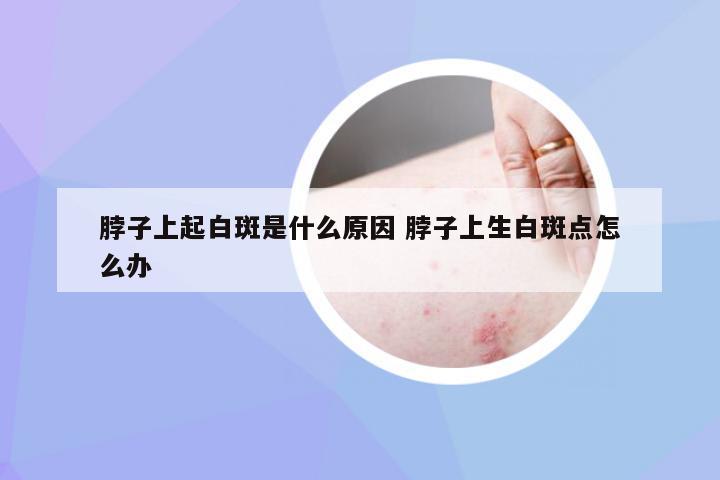 脖子上起白斑是什么原因 脖子上生白斑点怎么办