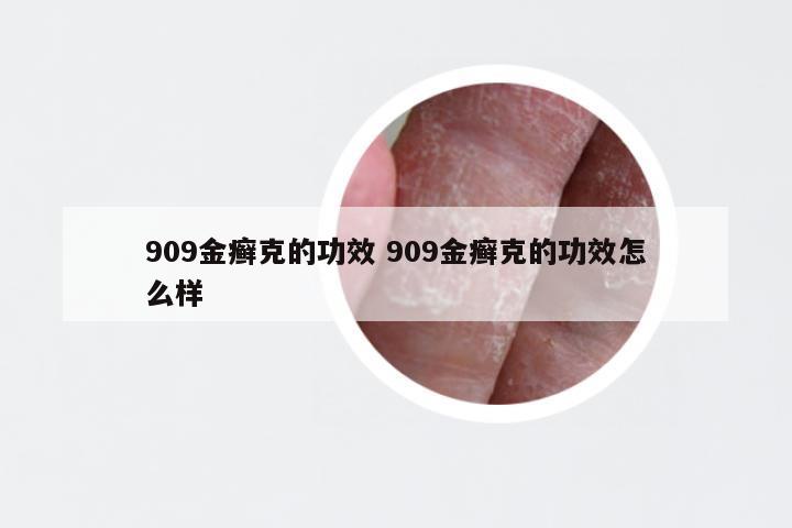 909金癣克的功效 909金癣克的功效怎么样