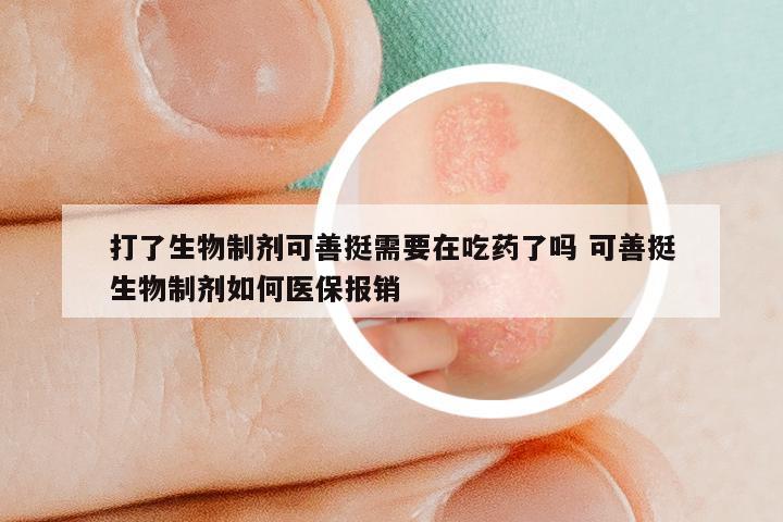 打了生物制剂可善挺需要在吃药了吗 可善挺生物制剂如何医保报销