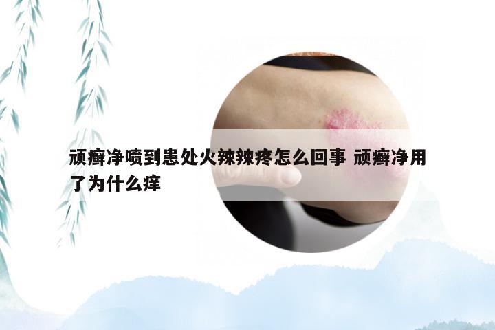 顽癣净喷到患处火辣辣疼怎么回事 顽癣净用了为什么痒