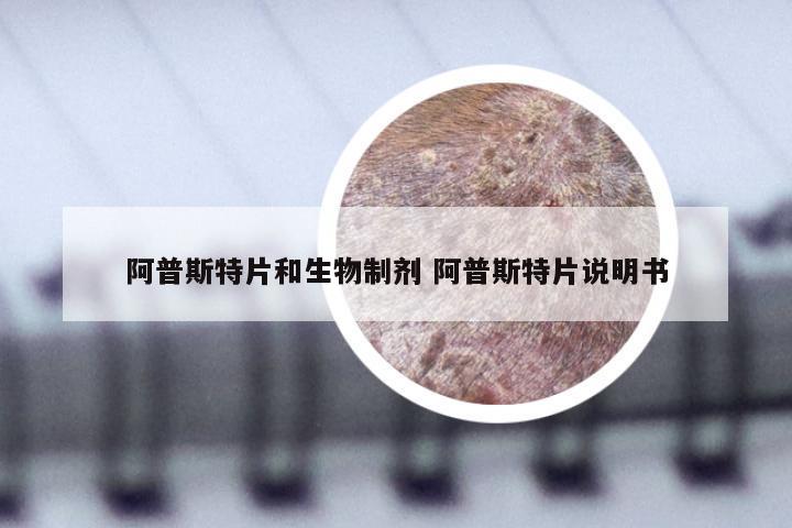 阿普斯特片和生物制剂 阿普斯特片说明书