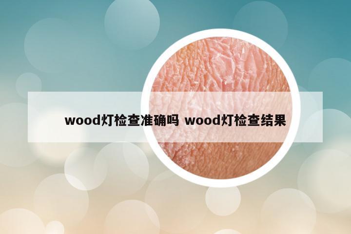 wood灯检查准确吗 wood灯检查结果