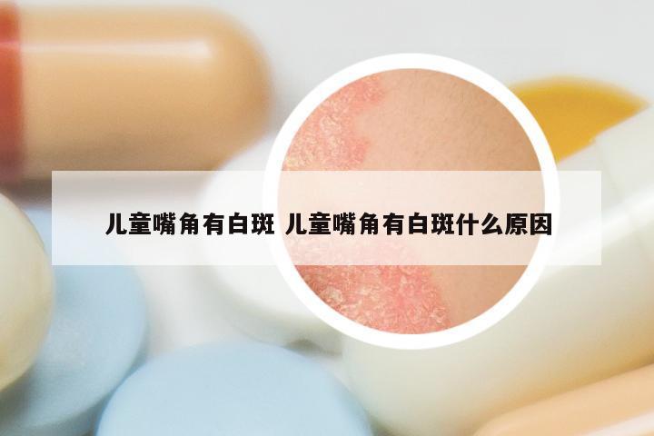 儿童嘴角有白斑 儿童嘴角有白斑什么原因