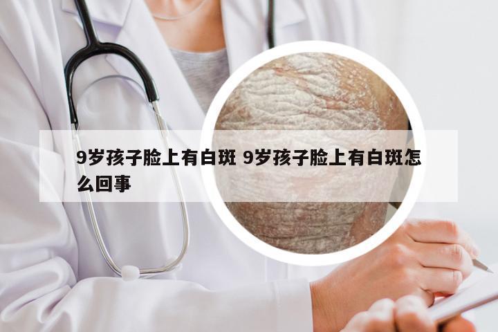 9岁孩子脸上有白斑 9岁孩子脸上有白斑怎么回事