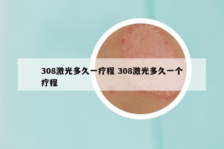 308激光多久一疗程 308激光多久一个疗程