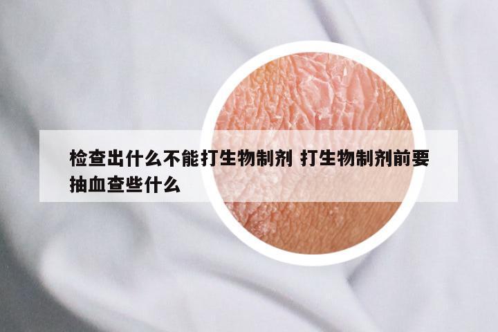 检查出什么不能打生物制剂 打生物制剂前要抽血查些什么