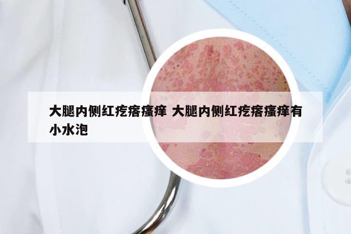 大腿内侧红疙瘩瘙痒 大腿内侧红疙瘩瘙痒有小水泡