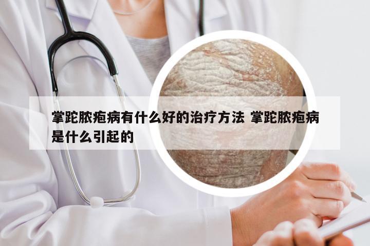 掌跎脓疱病有什么好的治疗方法 掌跎脓疱病是什么引起的