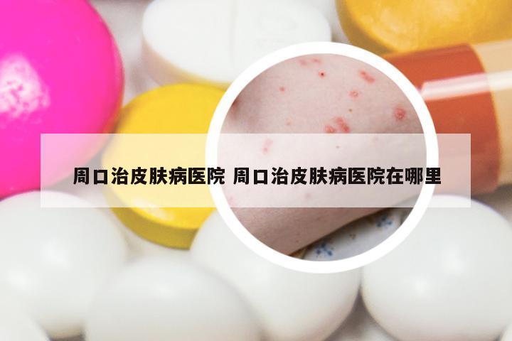 周口治皮肤病医院 周口治皮肤病医院在哪里