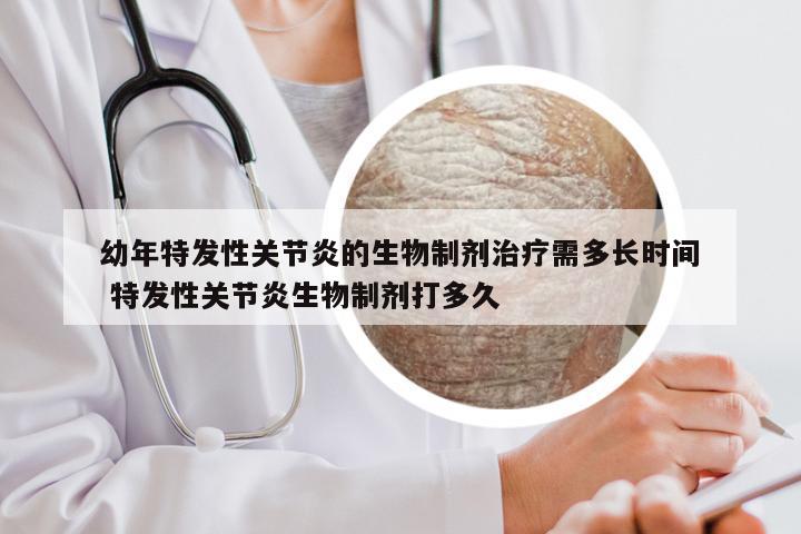 幼年特发性关节炎的生物制剂治疗需多长时间 特发性关节炎生物制剂打多久