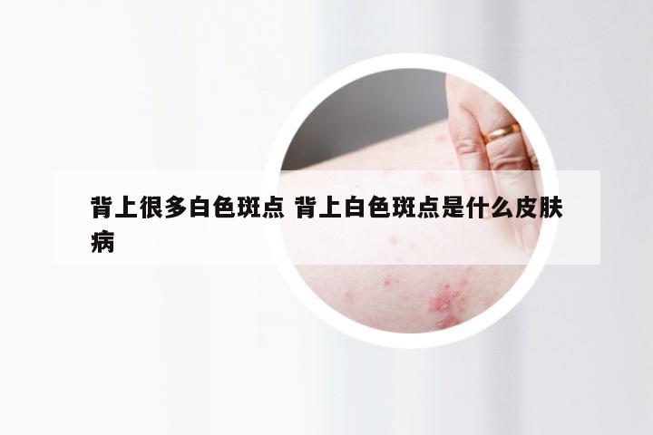 背上很多白色斑点 背上白色斑点是什么皮肤病