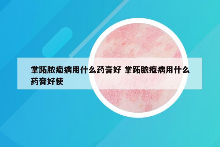 掌跖脓疱病用什么药膏好 掌跖脓疱病用什么药膏好使