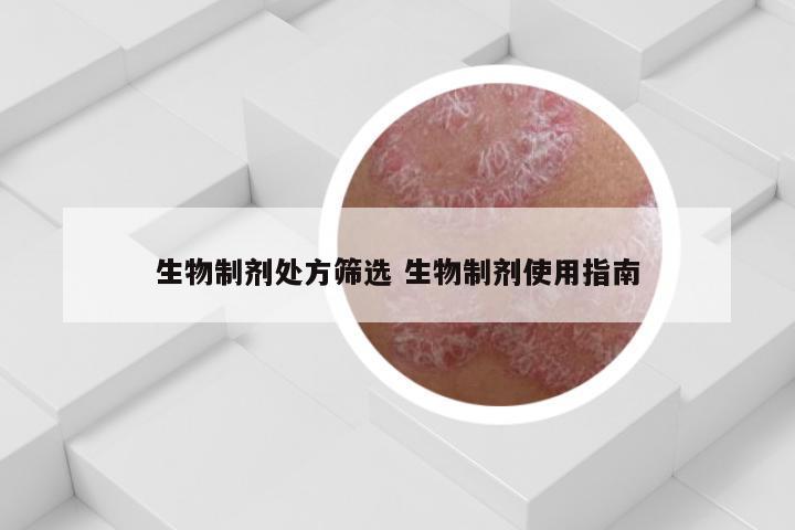 生物制剂处方筛选 生物制剂使用指南