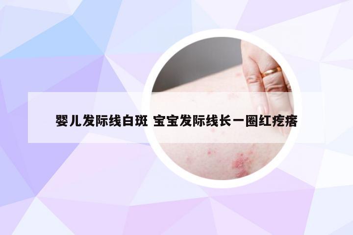 婴儿发际线白斑 宝宝发际线长一圈红疙瘩