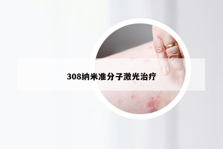 308纳米准分子激光治疗