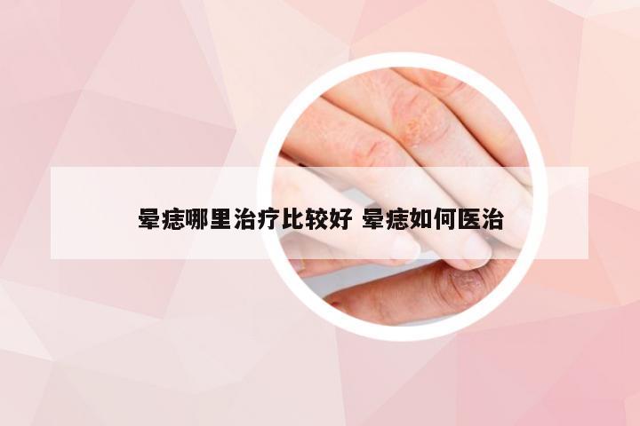 晕痣哪里治疗比较好 晕痣如何医治