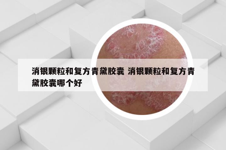 消银颗粒和复方青黛胶囊 消银颗粒和复方青黛胶囊哪个好