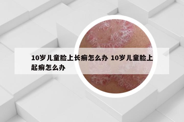 10岁儿童脸上长癣怎么办 10岁儿童脸上起癣怎么办