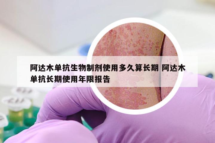 阿达木单抗生物制剂使用多久算长期 阿达木单抗长期使用年限报告