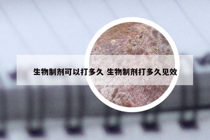 生物制剂可以打多久 生物制剂打多久见效