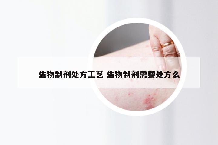 生物制剂处方工艺 生物制剂需要处方么