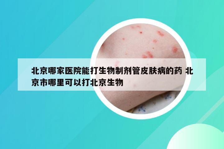 北京哪家医院能打生物制剂管皮肤病的药 北京市哪里可以打北京生物