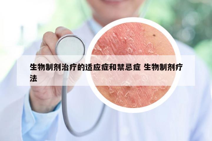 生物制剂治疗的适应症和禁忌症 生物制剂疗法