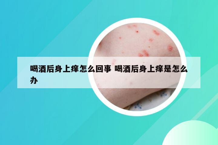 喝酒后身上痒怎么回事 喝酒后身上痒是怎么办