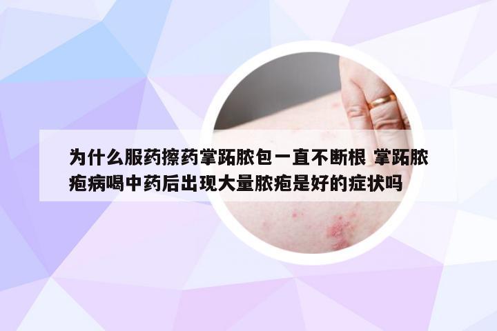 为什么服药擦药掌跖脓包一直不断根 掌跖脓疱病喝中药后出现大量脓疱是好的症状吗