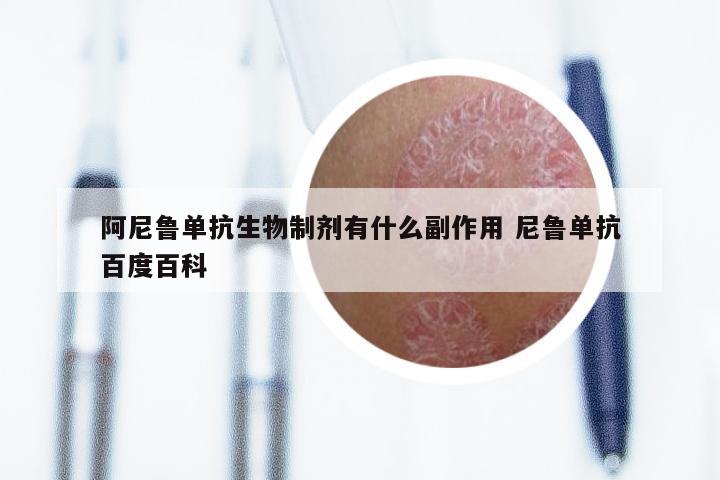 阿尼鲁单抗生物制剂有什么副作用 尼鲁单抗百度百科