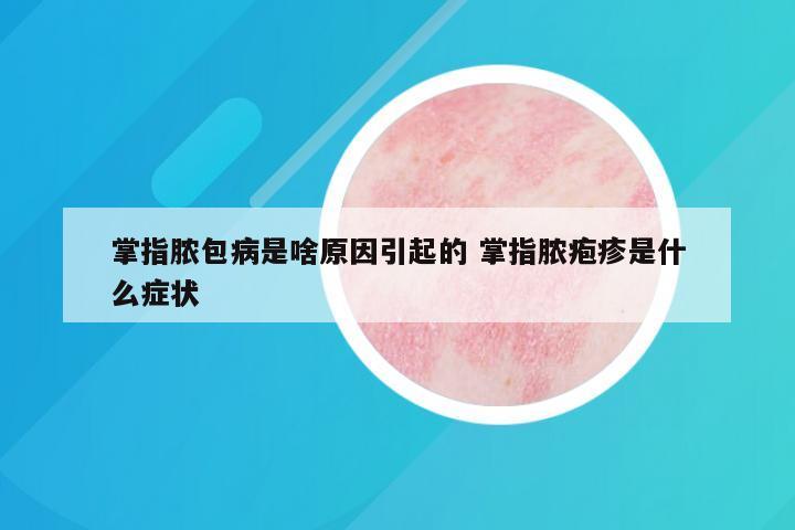 掌指脓包病是啥原因引起的 掌指脓疱疹是什么症状