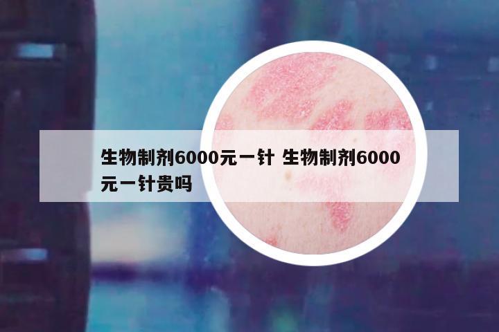 生物制剂6000元一针 生物制剂6000元一针贵吗