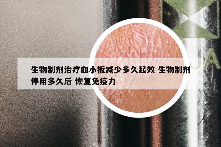 生物制剂治疗血小板减少多久起效 生物制剂停用多久后 恢复免疫力