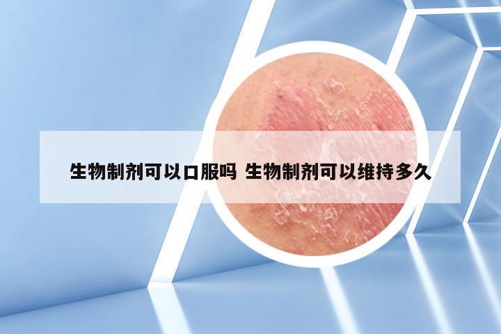 生物制剂可以口服吗 生物制剂可以维持多久