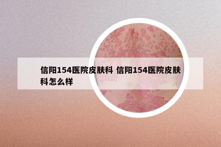 信阳154医院皮肤科 信阳154医院皮肤科怎么样