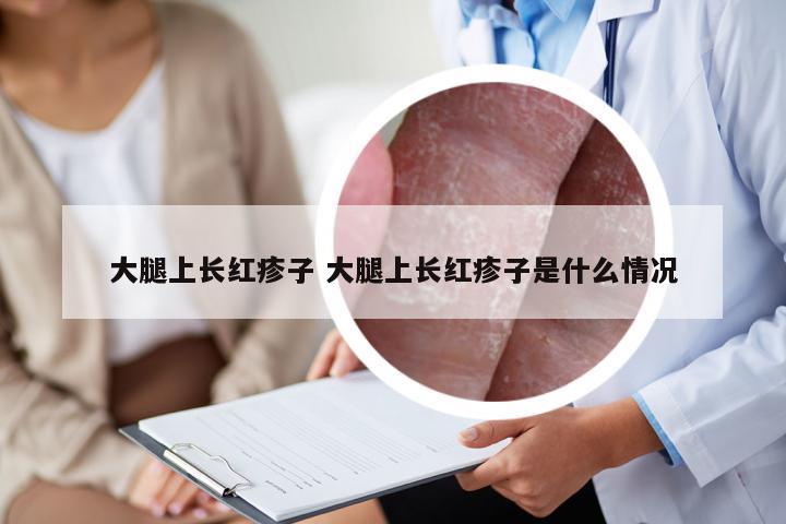 大腿上长红疹子 大腿上长红疹子是什么情况