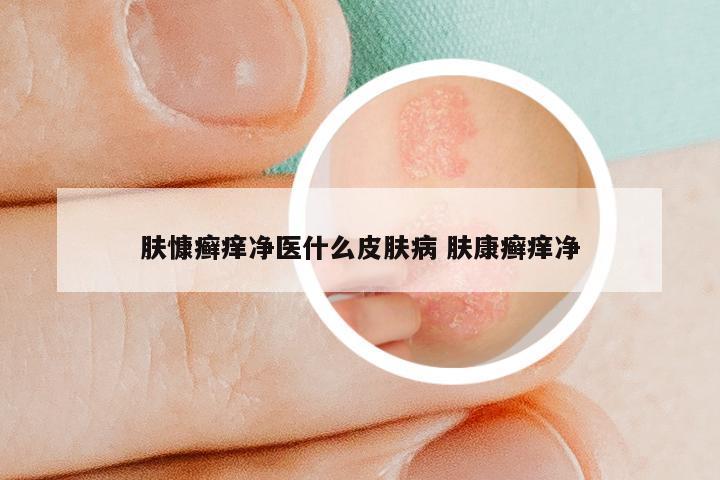 肤慷癣痒净医什么皮肤病 肤康癣痒净