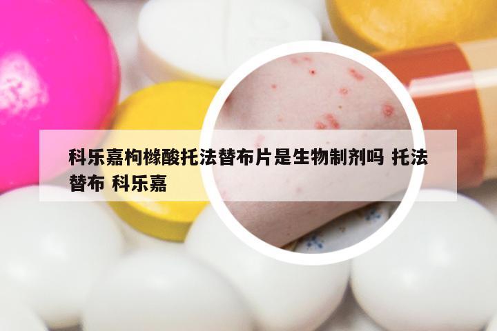 科乐嘉枸橼酸托法替布片是生物制剂吗 托法替布 科乐嘉