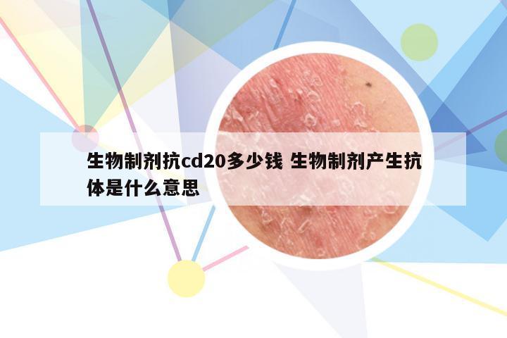 生物制剂抗cd20多少钱 生物制剂产生抗体是什么意思