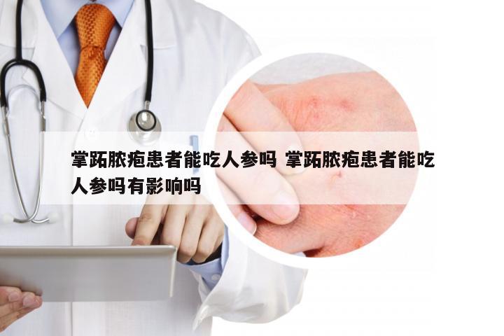 掌跖脓疱患者能吃人参吗 掌跖脓疱患者能吃人参吗有影响吗