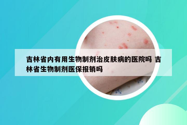 吉林省内有用生物制剂治皮肤病的医院吗 吉林省生物制剂医保报销吗