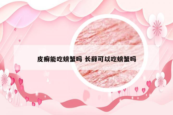 皮癣能吃螃蟹吗 长藓可以吃螃蟹吗