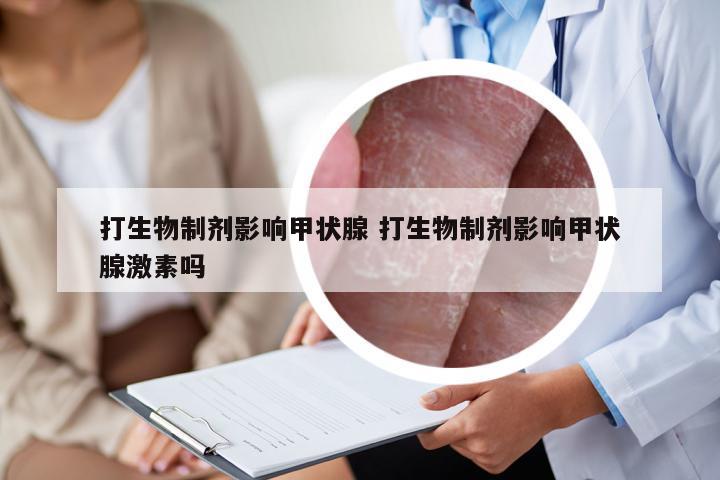 打生物制剂影响甲状腺 打生物制剂影响甲状腺激素吗