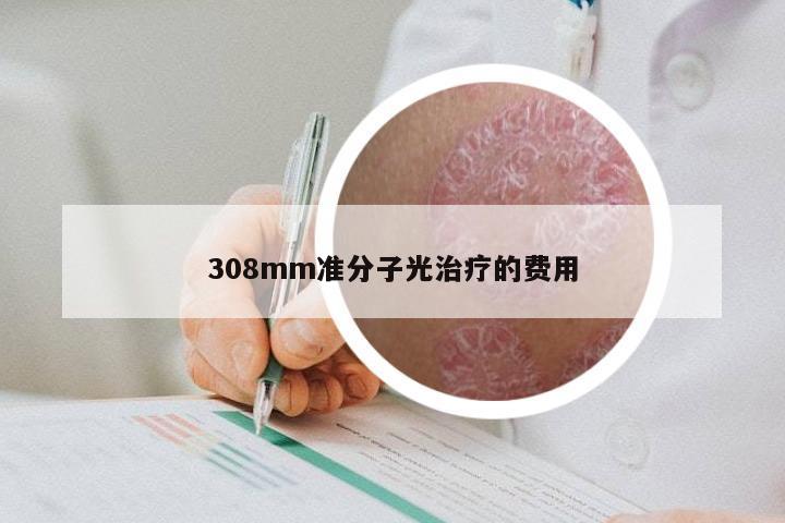 308mm准分子光治疗的费用