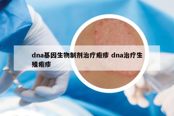 dna基因生物制剂治疗疱疹 dna治疗生殖疱疹