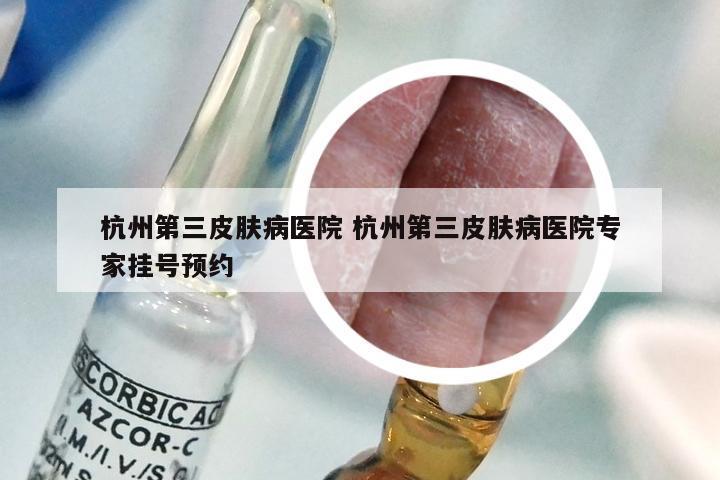 杭州第三皮肤病医院 杭州第三皮肤病医院专家挂号预约