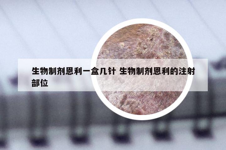 生物制剂恩利一盒几针 生物制剂恩利的注射部位