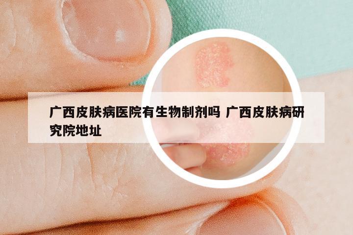 广西皮肤病医院有生物制剂吗 广西皮肤病研究院地址